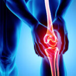 PRP Therapy for Knee Pain in Hyderabad: Advanced Non-Surgical Relief