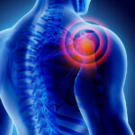 PRP Therapy for Rotator Cuff in Hyderabad: Advanced Non-Surgical Treatment