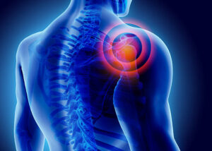 PRP Therapy for Rotator Cuff in Hyderabad: Advanced Non-Surgical Treatment