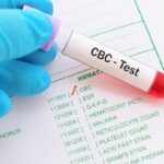 CBC-Blood-test-1024x768