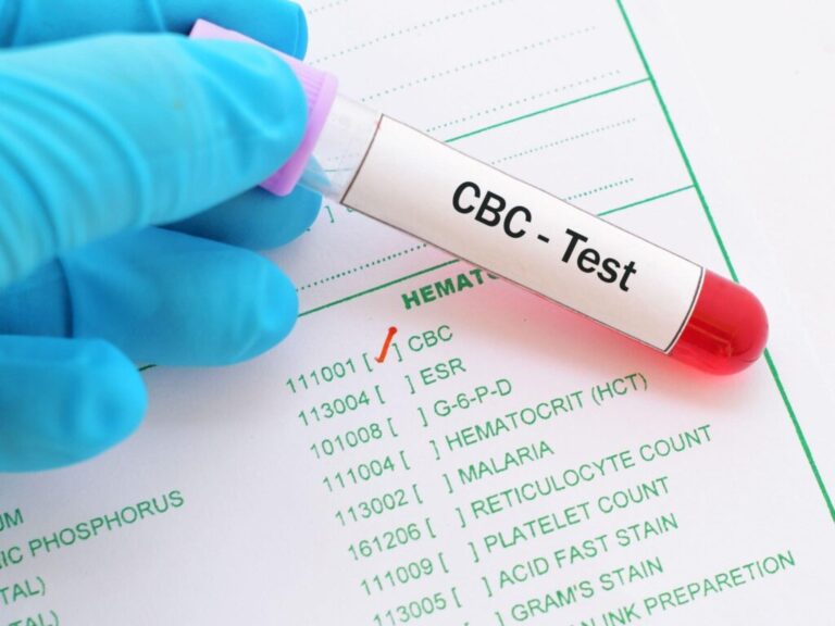 CBC-Blood-test-1024x768
