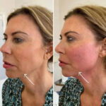 Best Aesthetic Clinic in dubai For Modern Non Surgical Rejuvenation
