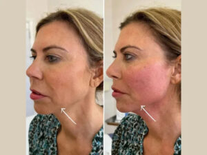 Best Aesthetic Clinic in dubai For Modern Non Surgical Rejuvenation