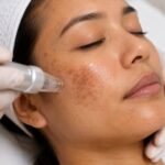 Pigmentation in Dubai