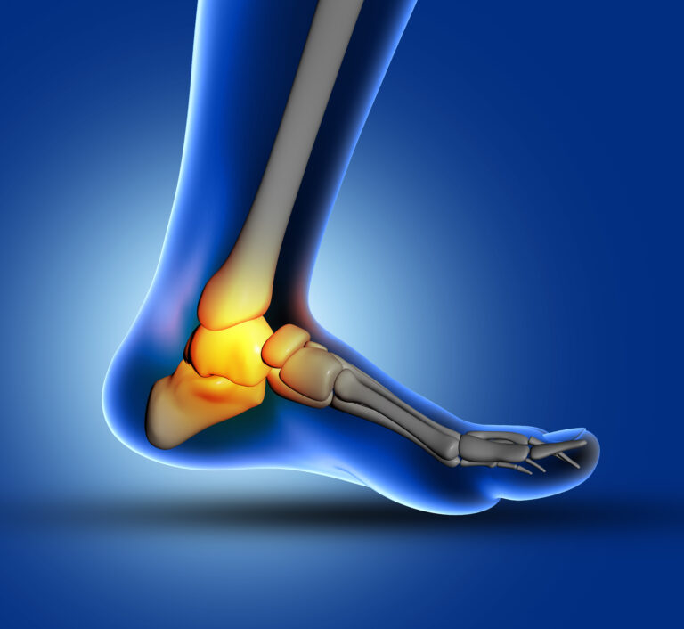 Stem Cell Therapy for Ankle Ligament Injury in Hyderabad: Explore Advanced Regenerative Care
